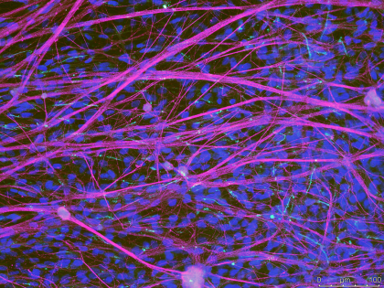 Immunostained primary sensory neurons under a microsope