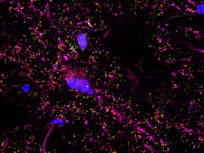 Occipital Cortex Synapses showing microscopic lines and dots that are pink and purple